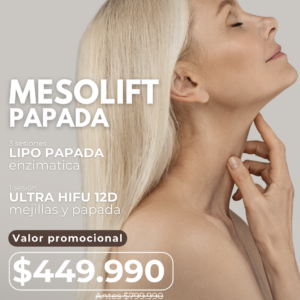 mesolift papada