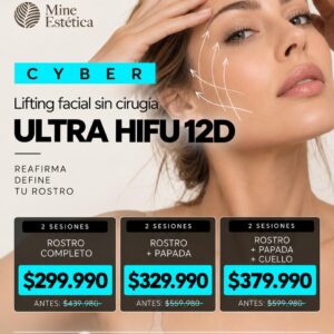 Ultra HIFU 12D - Lifting facial sin cirugía 2